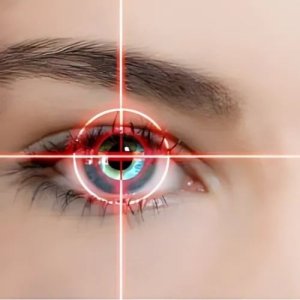 Lazerle Göz Çizdirme